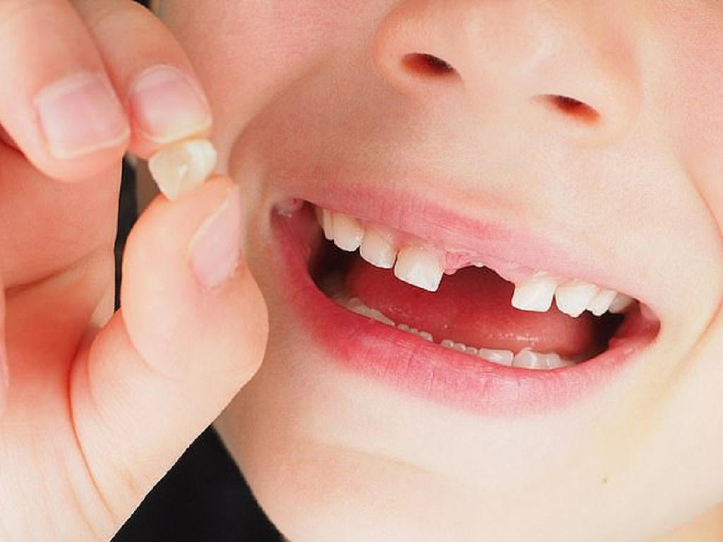 Cách vệ sinh răng miệng đúng cách cho trẻ sau nhổ răng